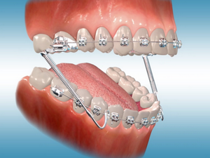 Orthodontics