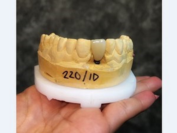 Implant solutions2